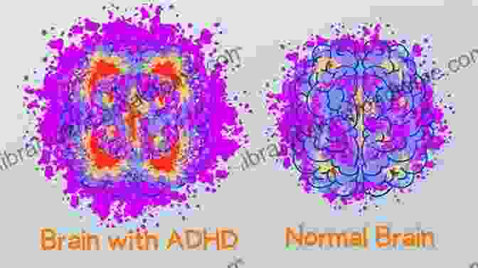 Brain Scan Showing Differences In ADHD Brain Activity The Disorganized Mind: Coaching Your ADHD Brain To Take Control Of Your Time Tasks And Talents