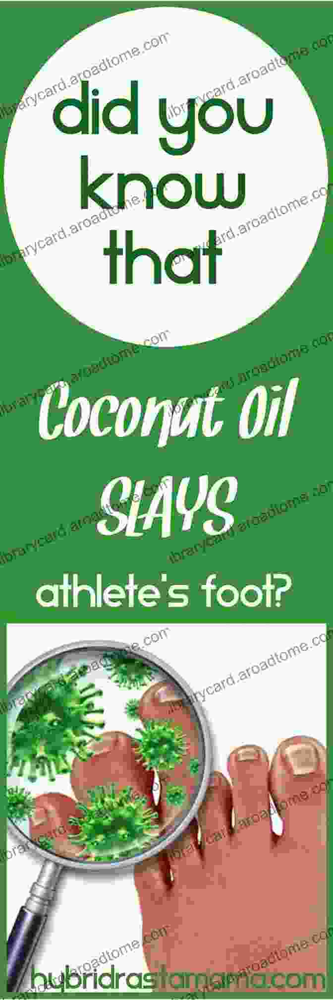 Coconut Oil For Athlete's Foot Tried And Tested Home Remedies To Treat Athlete S Foot