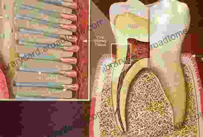 Image Of A Person Experiencing Dentin Hypersensitivity, Showing Pain When Exposed To Cold Or Heat Pathology Of The Hard Dental Tissues