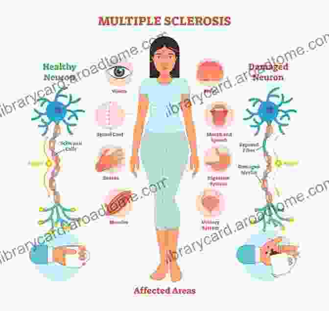 Image Showing Various Symptoms Of Multiple Sclerosis, Such As Fatigue, Cognitive Difficulties, And Physical Impairments MS And Your Feelings: Handling The Ups And Downs Of Multiple Sclerosis