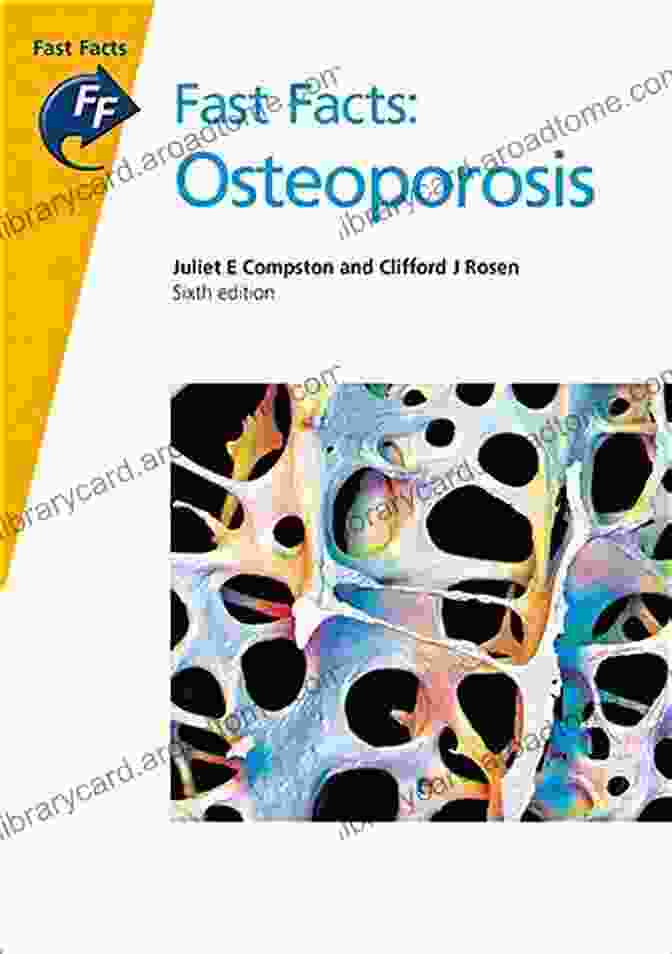 Osteoporosis The Facts Book Cover Osteoporosis: The Facts Alison J Black