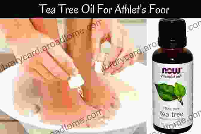 Tea Tree Oil For Athlete's Foot Tried And Tested Home Remedies To Treat Athlete S Foot